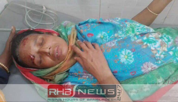 নওগাঁর সাপাহারে শিয়ালের কামড়ে নারী..