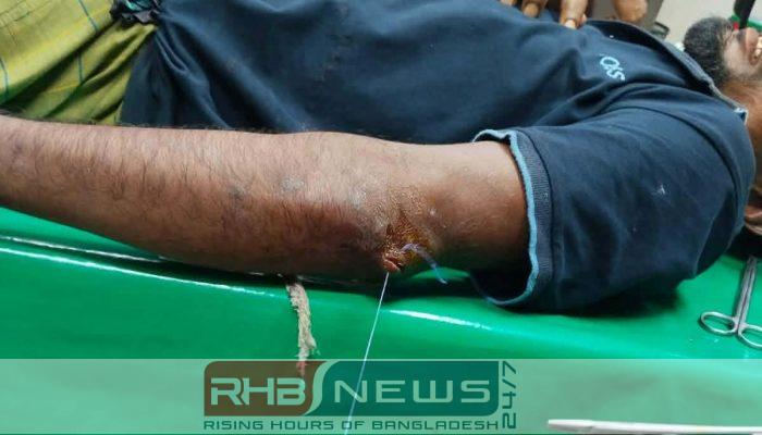 রাঙ্গাবালীতে দুই পক্ষের সংঘর্ষ, আহত..